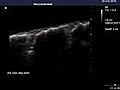 Ex-vivo spine in Mechanical Testing | BahVideo.com
