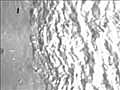 Nanobubbles Blast Blocked Arteries | BahVideo.com