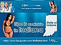 Lipo Indiana | BahVideo.com