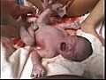 Natural Childbirth | BahVideo.com