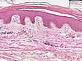 Histology of Thin Skin | BahVideo.com