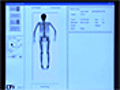 Preventing Bone Complications From BoneMetastases | BahVideo.com