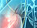 Heart Catheterization Animation | BahVideo.com