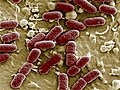 Deadly E coli is new strain of bacteria | BahVideo.com