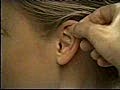 Ear Examination | BahVideo.com