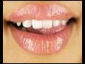 Ortodonti nedir  | BahVideo.com