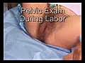 Pelvic Exam During Labor | BahVideo.com