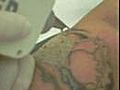 Remo o de Tatuagem - tattoo Removal | BahVideo.com