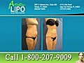 Tampa Lipo and Body Contouring | BahVideo.com