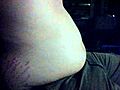 Belly bloat | BahVideo.com