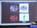 E-records can be virtual medicine for cancer  | BahVideo.com