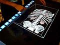 Multitouch Digital Autopsy System - iDASSmart | BahVideo.com