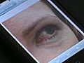 EyeSnapi lets doctors see patient s eyes  | BahVideo.com