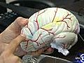 Medical advances help brain injury patients survive | BahVideo.com