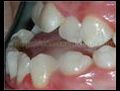 Ortodontik tedaviler pahali midir  | BahVideo.com