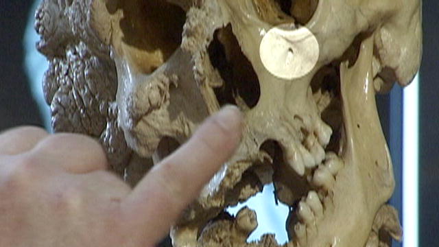 Curse of the Elephant Man Skeleton | BahVideo.com