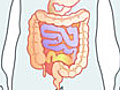 Crohn s Disease Basics and Diagnosis | BahVideo.com
