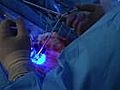 Surgeons use florescent light to target brain  | BahVideo.com