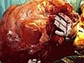 Doctors remove 25kg tumour | BahVideo.com