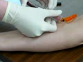 Drawing Blood Sample Venipuncture | BahVideo.com