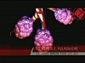 Les alv oles pulmonaires haut lieu des changes gazeux | BahVideo.com