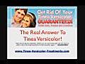 How To Get Rid Of Tinea Versicolor Naturally | BahVideo.com