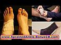 Sprained Ankle tratment Common Sports Injuries | BahVideo.com