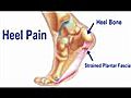 Heel Pain Treatment - Podiatrist in Wappingers  | BahVideo.com