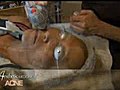 Aesthetic Medicine - Acne | BahVideo.com