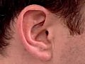 Ear Exam | BahVideo.com