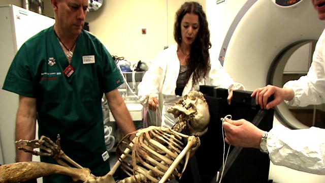 Elephant Man Autopsy Model 3D | BahVideo.com