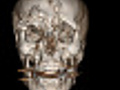 CAT Scan of Human Head | BahVideo.com