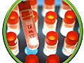 NOVA scienceNOW Stem Cells | BahVideo.com