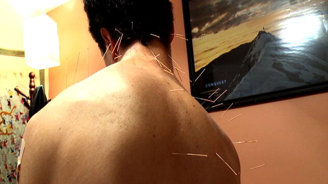 Elephant Man Autopsy Acupuncture | BahVideo.com