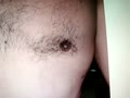 breast surgery-gynecomastia | BahVideo.com