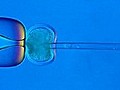 Bundestag stimmt f r Gentests an Embryonen | BahVideo.com