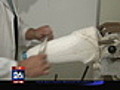 Houstonians Donate Prosthetics to Haiti | BahVideo.com