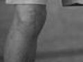 Healing Arthritic Knees With a Robot | BahVideo.com