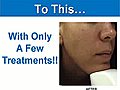 Sherman Oaks Dermatologist | BahVideo.com