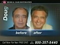 Cause of Hair Loss | BahVideo.com