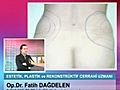 Liposuction Nedir  | BahVideo.com