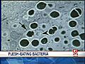 Expert Talks About Flesh-Eating Bacteria | BahVideo.com