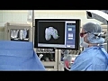 Seattle Hosp Surgery Webcast Today | BahVideo.com