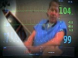 Study Says High Percentage of Sudden  | BahVideo.com