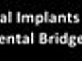 Cosmetic Dentist Harrisonburg VA Dental Implants Dental Bridge | BahVideo.com