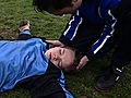 Erste Hilfe - Kopfverletzung Gehirnersch tterung | BahVideo.com