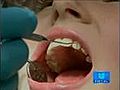 Nuevas t cnicas para enderezar tu dentadura | BahVideo.com