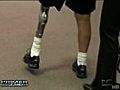 Perdi su pierna pero gan mucho m s | BahVideo.com