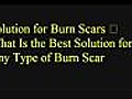 Cures for Burn Scars What Is the Most excellent Solution for Any Type of Burn Scar | BahVideo.com